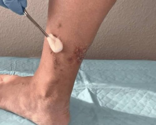 xr:d:DAFguyNjG64:8,j:3213318798,t:23042207