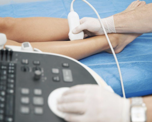 what-is-a-venous-doppler-1024x589